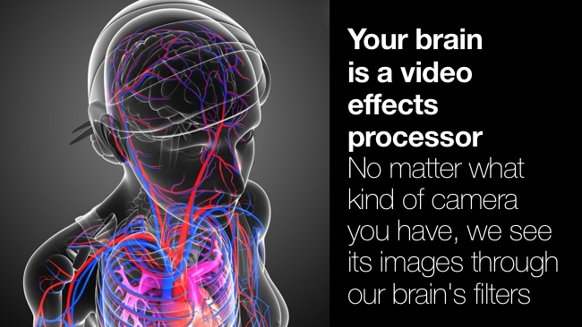 The brain's video filters RedShark/Shutterstock