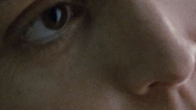 A 100% crop of Aliens. Sigourney doens't have a skin condition - it's grain. Sort of a lot of grain